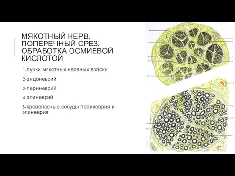 МЯКОТНЫЙ НЕРВ. ПОПЕРЕЧНЫЙ СРЕЗ. ОБРАБОТКА ОСМИЕВОЙ КИСЛОТОЙ 1-пучки мякотных нервных волокн