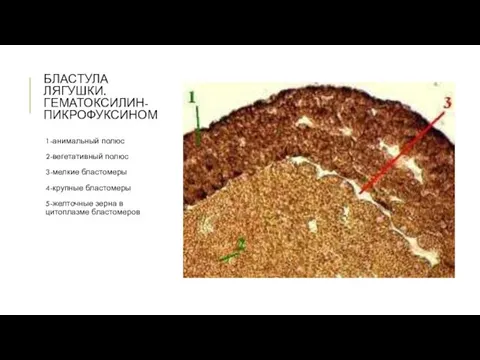 БЛАСТУЛА ЛЯГУШКИ. ГЕМАТОКСИЛИН-ПИКРОФУКСИНОМ 1-анимальный полюс 2-вегетативный полюс 3-мелкие бластомеры 4-крупные бластомеры 5-желточные зерна в цитоплазме бластомеров