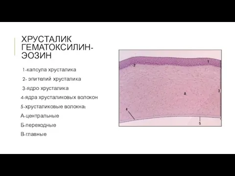 ХРУСТАЛИК ГЕМАТОКСИЛИН-ЭОЗИН 1-капсула хрусталика 2- эпителий хрусталика 3-ядро хрусталика 4-ядра хрусталиковых