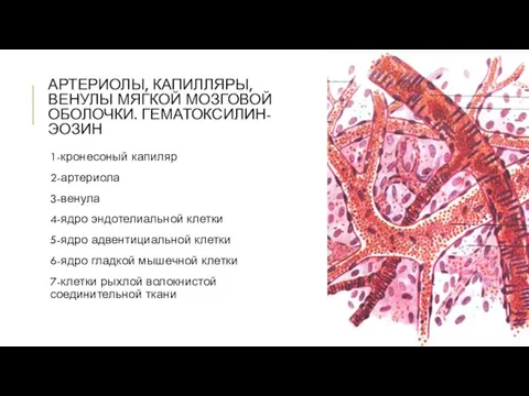 АРТЕРИОЛЫ, КАПИЛЛЯРЫ, ВЕНУЛЫ МЯГКОЙ МОЗГОВОЙ ОБОЛОЧКИ. ГЕМАТОКСИЛИН-ЭОЗИН 1-кронесоный капиляр 2-артериола 3-венула