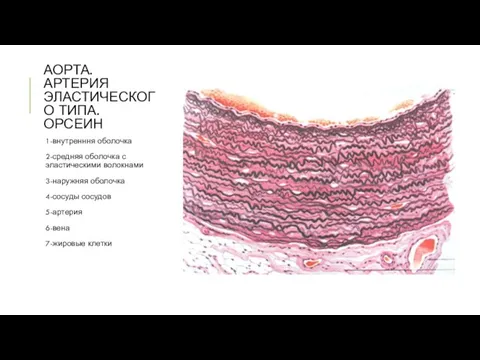 АОРТА. АРТЕРИЯ ЭЛАСТИЧЕСКОГО ТИПА. ОРСЕИН 1-внутренння оболочка 2-средняя оболочка с эластическими