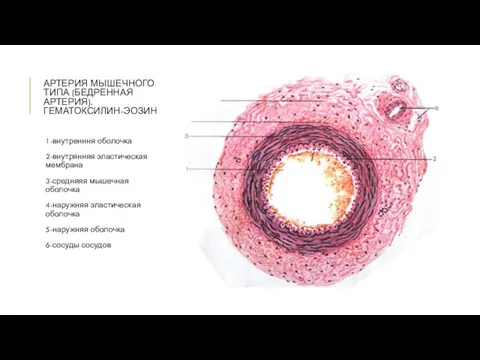 АРТЕРИЯ МЫШЕЧНОГО ТИПА (БЕДРЕННАЯ АРТЕРИЯ). ГЕМАТОКСИЛИН-ЭОЗИН 1-внутренння оболочка 2-внутрянняя эластическая мембрана