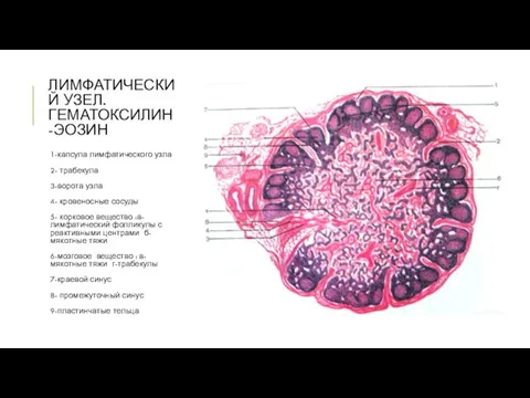 ЛИМФАТИЧЕСКИЙ УЗЕЛ. ГЕМАТОКСИЛИН-ЭОЗИН 1-капсула лимфатического узла 2- трабекула 3-ворота узла 4-