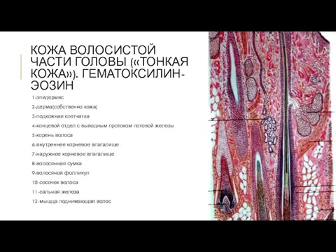 КОЖА ВОЛОСИСТОЙ ЧАСТИ ГОЛОВЫ («ТОНКАЯ КОЖА»). ГЕМАТОКСИЛИН-ЭОЗИН 1-эпидермис 2-дерма(собственно кожа) 3-подкожная