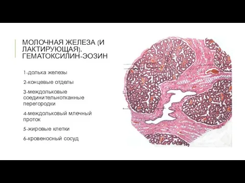 МОЛОЧНАЯ ЖЕЛЕЗА (И ЛАКТИРУЮЩАЯ). ГЕМАТОКСИЛИН-ЭОЗИН 1-долька железы 2-концевые отделы 3-междольковые соединительнотканные