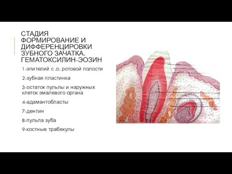 СТАДИЯ ФОРМИРОВАНИЕ И ДИФФЕРЕНЦИРОВКИ ЗУБНОГО ЗАЧАТКА. ГЕМАТОКСИЛИН-ЭОЗИН 1-эпителий с .о. ротовой