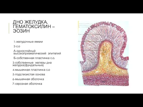 ДНО ЖЕЛУДКА. ГЕМАТОКСИЛИН –ЭОЗИН 1-желудочные ямкии 2-с.о А-однослойный высокопризматический эпителий Б-собственная