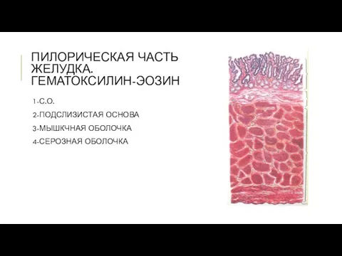 ПИЛОРИЧЕСКАЯ ЧАСТЬ ЖЕЛУДКА. ГЕМАТОКСИЛИН-ЭОЗИН 1-С.О. 2-ПОДСЛИЗИСТАЯ ОСНОВА 3-МЫШКЧНАЯ ОБОЛОЧКА 4-СЕРОЗНАЯ ОБОЛОЧКА