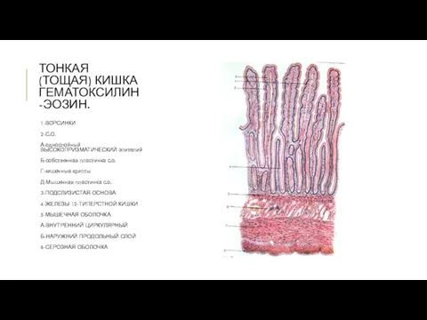 ТОНКАЯ (ТОЩАЯ) КИШКА ГЕМАТОКСИЛИН-ЭОЗИН. 1-ВОРСИНКИ 2-С.О. А-однослойный ВЫСОКОПРИЗМАТИЧЕСКИЙ эпителий Б-собственная пластинка