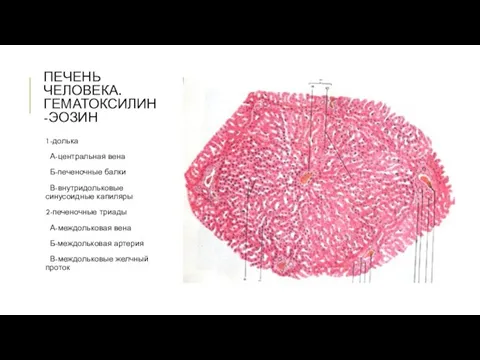 ПЕЧЕНЬ ЧЕЛОВЕКА. ГЕМАТОКСИЛИН-ЭОЗИН 1-долька А-центральная вена Б-печеночные балки В-внутридольковые синусоидные капиляры