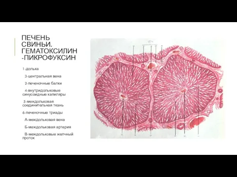 ПЕЧЕНЬ СВИНЬИ. ГЕМАТОКСИЛИН-ПИКРОФУКСИН 1-долька 3-центральная вена 2-печеночные балки 4-внутридольковые синусоидные капиляры