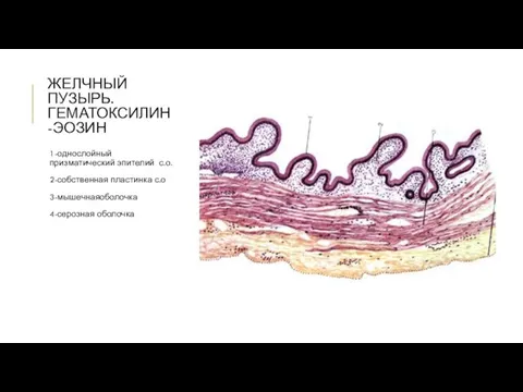 ЖЕЛЧНЫЙ ПУЗЫРЬ. ГЕМАТОКСИЛИН-ЭОЗИН 1-однослойный призматический эпителий с.о. 2-собственная пластинка с.о 3-мышечнаяоболочка 4-серозная оболочка