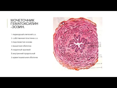 МОЧЕТОЧНИК ГЕМАТОКСИЛИН-ЭОЗИН. 1-переходный эпителий с.о. 2- собственная пластинка с.о. 3-подслизистая основа