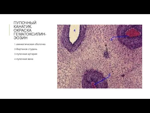 ПУПОЧНЫЙ КАНАТИК. ОКРАСКА ГЕМАТОКСИЛИН-ЭОЗИН 1-амниатическая оболочка 2-Вартанов студень 3-пупочная артерия 4-пупочная вена