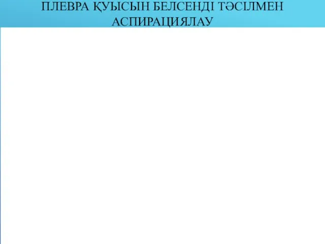 ПЛЕВРА ҚУЫСЫН БЕЛСЕНДІ ТӘСІЛМЕН АСПИРАЦИЯЛАУ