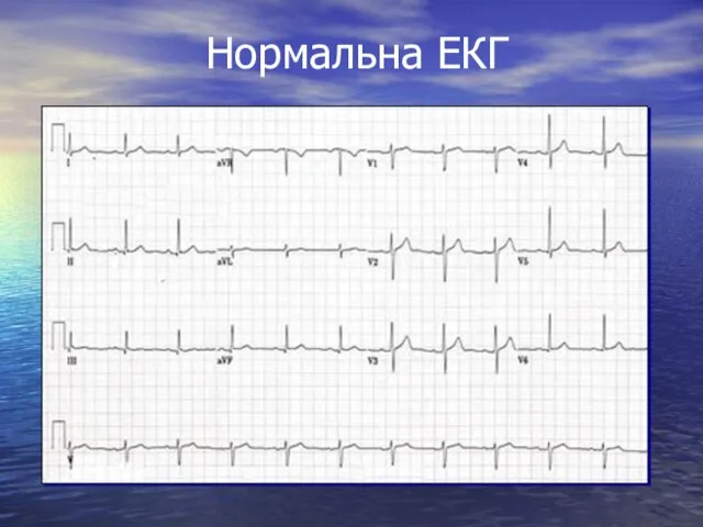 Нормальна ЕКГ