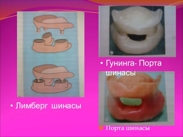 Порта шинасы Гунинга- Порта шинасы Лимберг шинасы