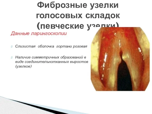 Данные ларингоскопии Слизистая оболочка гортани розовая Наличие симметричных образований в виде