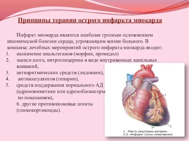 Принципы терапии острого инфаркта миокарда Инфаркт миокарда является наиболее грозным осложнением