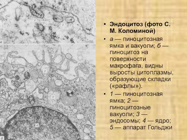 Эндоцитоз (фото С.М. Коломиной) а — пиноцитозная ямка и вакуоли; б