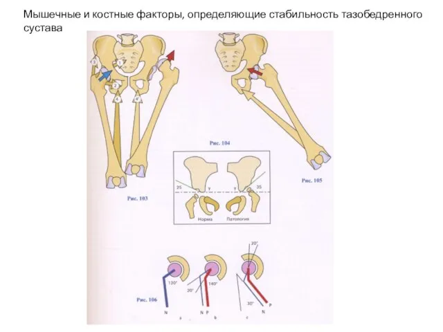 Мышечные и костные факторы, определяющие стабильность тазобедренного сустава