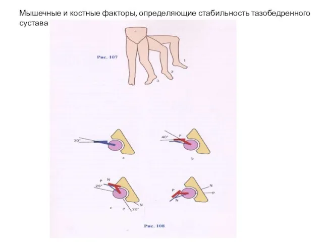 Мышечные и костные факторы, определяющие стабильность тазобедренного сустава