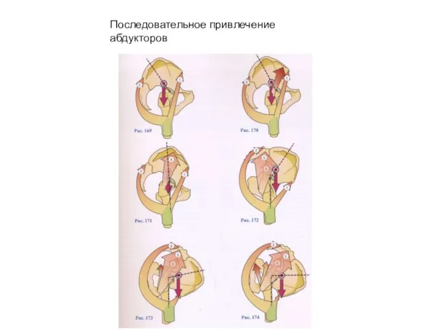 Последовательное привлечение абдукторов