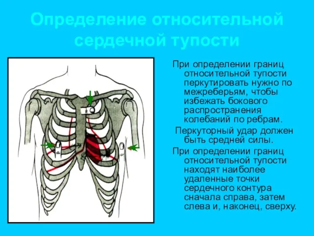 Определение относительной сердечной тупости При определении границ относительной тупости перкутировать нужно