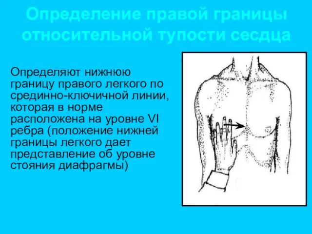 Определение правой границы относительной тупости сесдца Определяют нижнюю границу правого легкого