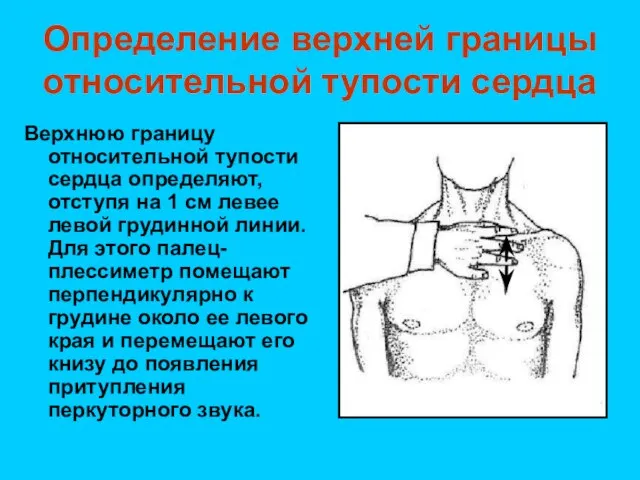 Определение верхней границы относительной тупости сердца Верхнюю границу относительной тупости сердца