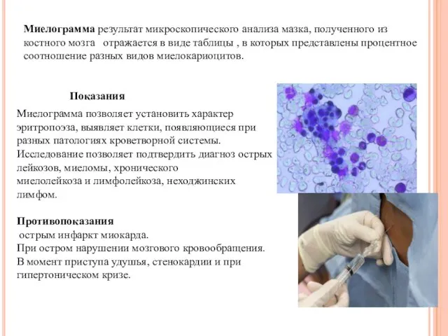 Миелограмма результат микроскопического анализа мазка, полученного из костного мозга отражается в