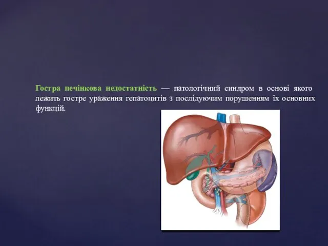 Гостра печінкова недостатність — патологічний синдром в основі якого лежить гостре