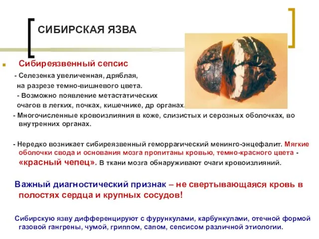 СИБИРСКАЯ ЯЗВА Сибиреязвенный сепсис - Селезенка увеличенная, дряблая, на разрезе темно-вишневого