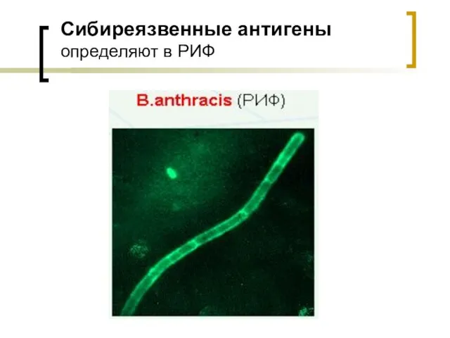 Сибиреязвенные антигены определяют в РИФ