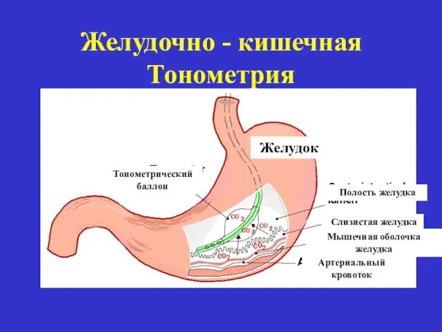 Желудочно - кишечная Тонометрия Желудок Полость желудка Слизистая желудка Мышечная оболочка желудка Артериальный кровоток Тонометрический баллон