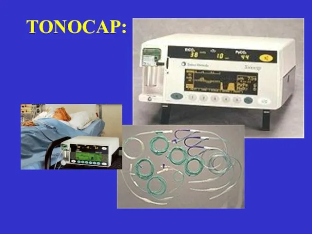 TONOCAP: