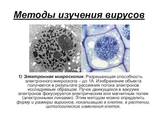 Методы изучения вирусов 1) Электронная микроскопия. Разрешающая способность электронного микроскопа –