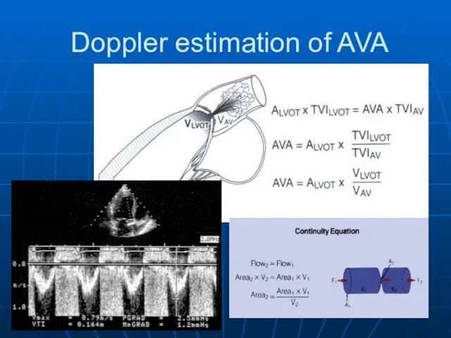 Doppler estimation of AVA