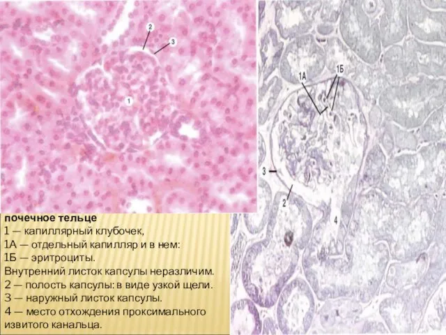 почечное тельце 1 — капиллярный клубочек, 1А — отдельный капилляр и