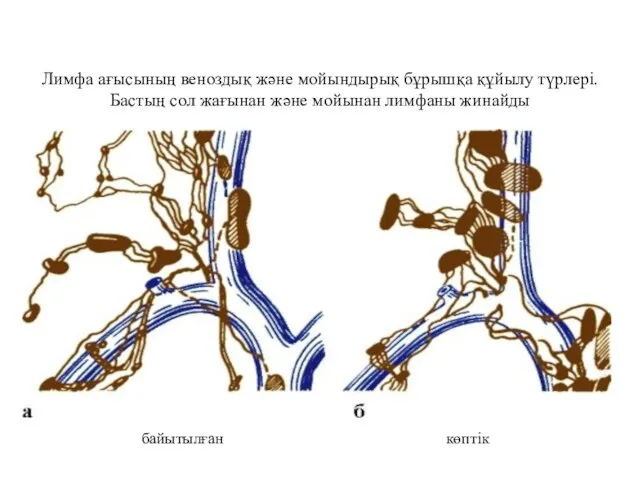 Лимфа ағысының веноздық және мойындырық бұрышқа құйылу түрлері. Бастың сол жағынан