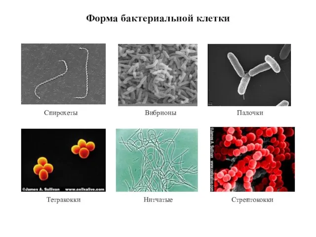 Спирохеты Тетракокки Вибрионы Нитчатые Палочки Стрептококки Форма бактериальной клетки