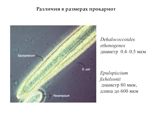 Различия в размерах прокариот Dehalococcoides ethenogenes диаметр 0.4–0.5 мкм Epulopiscium ﬁshelsonii