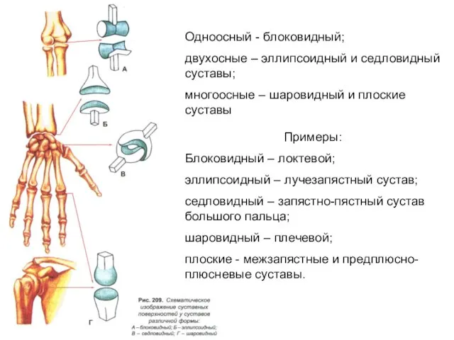 Примеры: Блоковидный – локтевой; эллипсоидный – лучезапястный сустав; седловидный – запястно-пястный