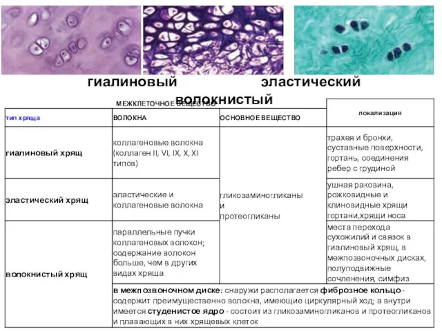 гиалиновый эластический волокнистый