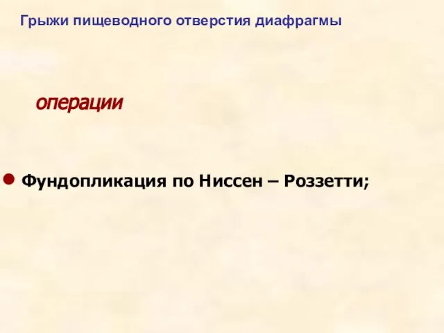 операции Фундопликация по Ниссен – Роззетти; Грыжи пищеводного отверстия диафрагмы