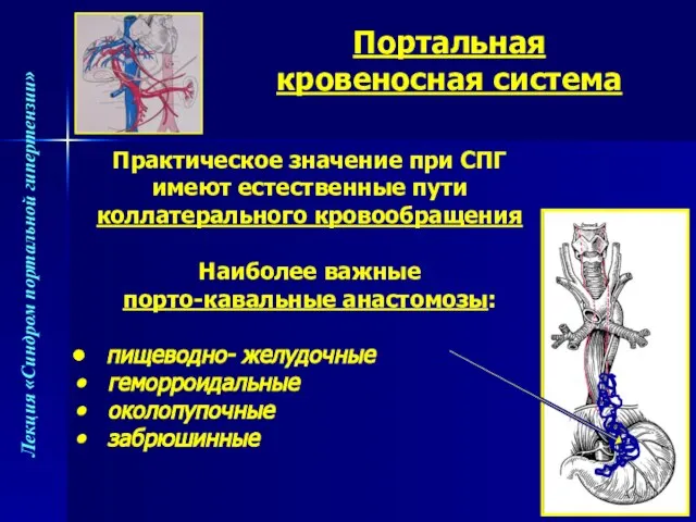 Портальная кровеносная система Практическое значение при СПГ имеют естественные пути коллатерального