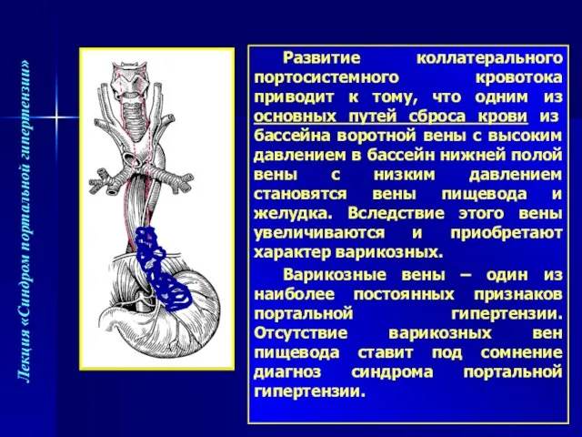 Развитие коллатерального портосистемного кровотока приводит к тому, что одним из основных