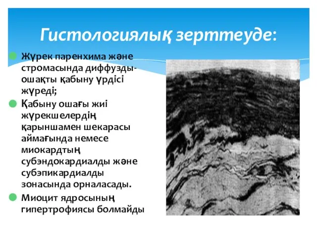 Гистологиялық зерттеуде: Жүрек паренхима және стромасында диффузды- ошақты қабыну үрдісі жүреді;