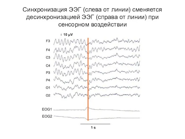 Синхронизация ЭЭГ (слева от линии) сменяется десинхронизацией ЭЭГ (справа от линии) при сенсорном воздействии