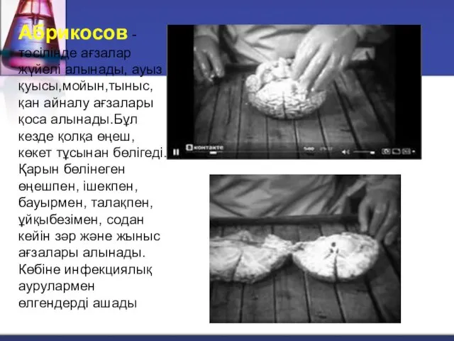 Абрикосов -тәсілінде ағзалар жүйелі алынады, ауыз қуысы,мойын,тыныс, қан айналу ағзалары қоса